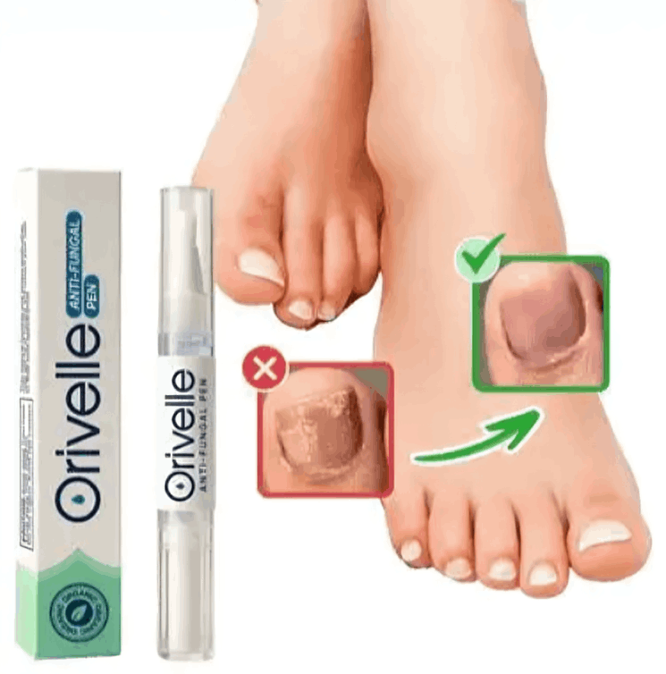 what is Orivelle Anti-Fungal Pen